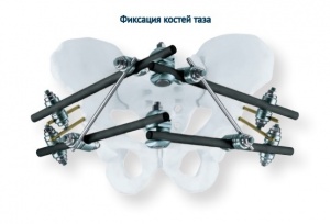 Зажим трубка к трубке